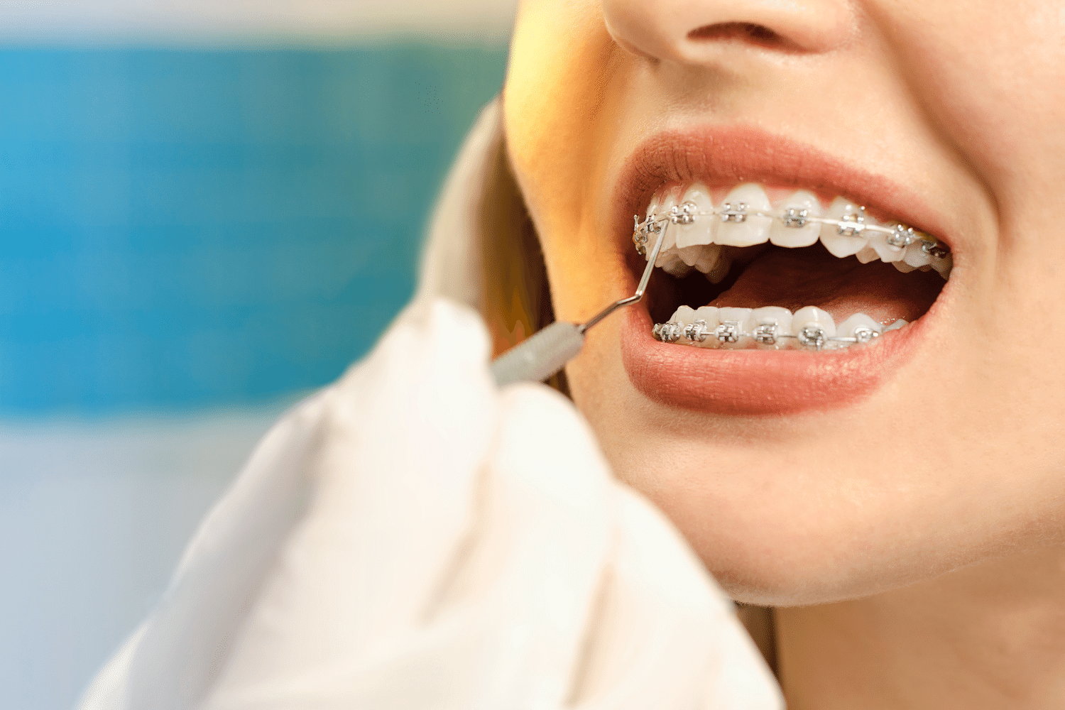 Orthodontie à Rabat